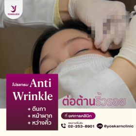 Antiwrinkle-680x680.jpg